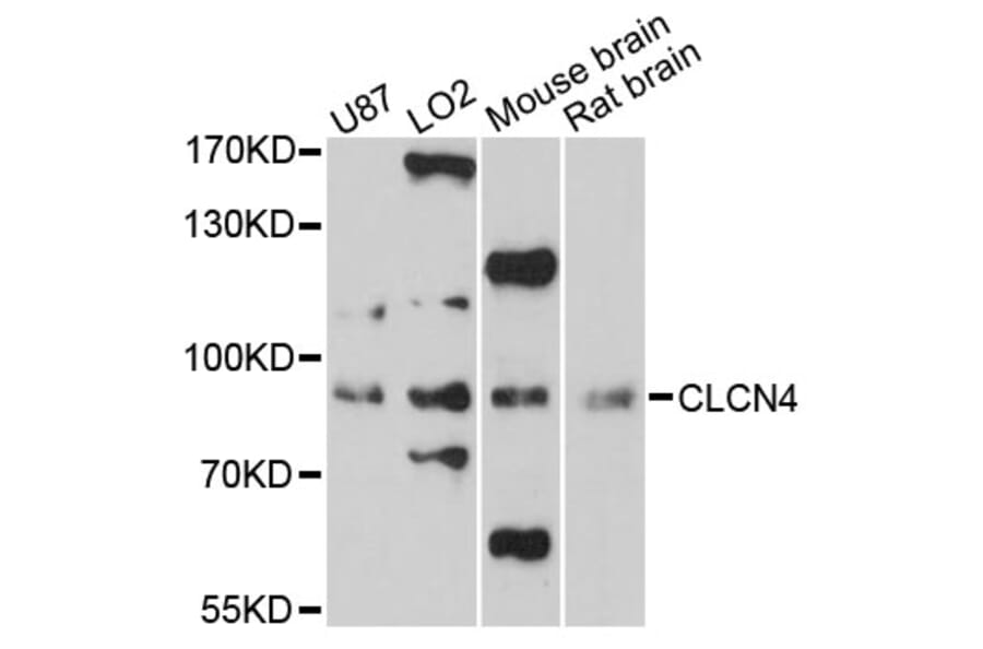 Western Blot - Anti-CLCN4 Antibody (A13790) - Antibodies.com