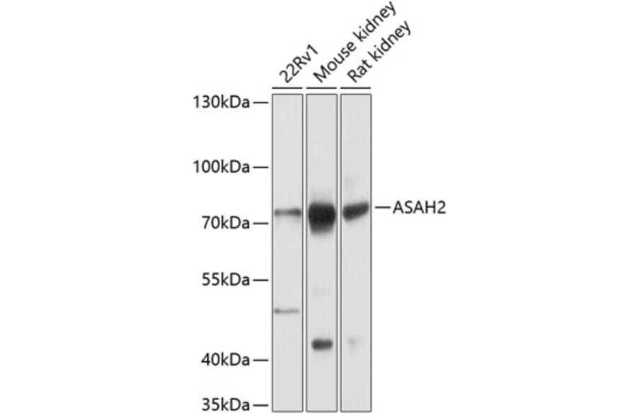 Western Blot - Anti-ASAH2 Antibody (A91357) - Antibodies.com