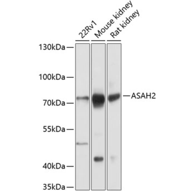 Western Blot - Anti-ASAH2 Antibody (A91357) - Antibodies.com