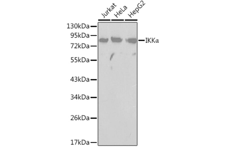 Western Blot - Anti-IKK alpha Antibody (A91358) - Antibodies.com