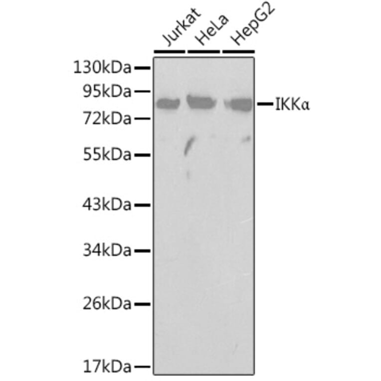 Western Blot - Anti-IKK alpha Antibody (A91358) - Antibodies.com