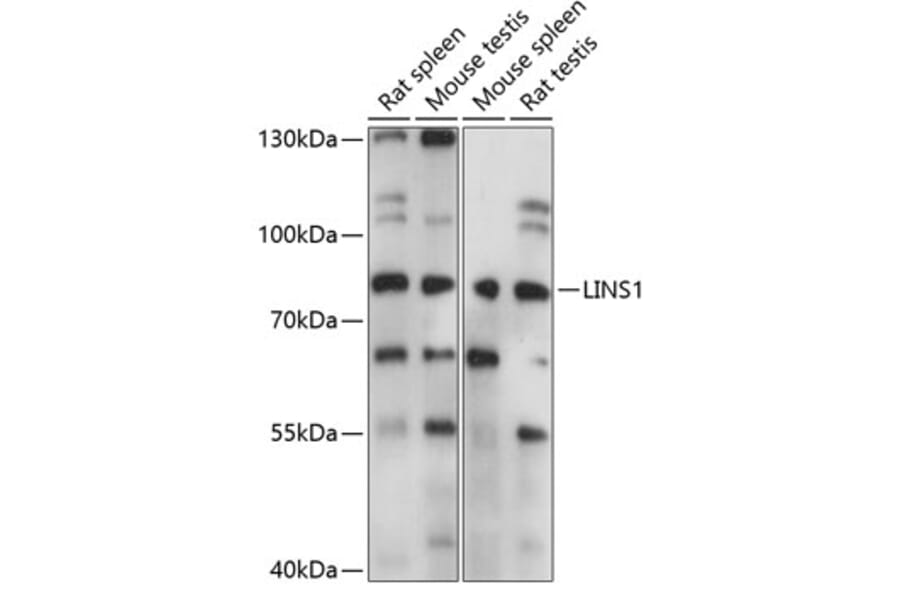 Western Blot - Anti-LINS1 Antibody (A91359) - Antibodies.com