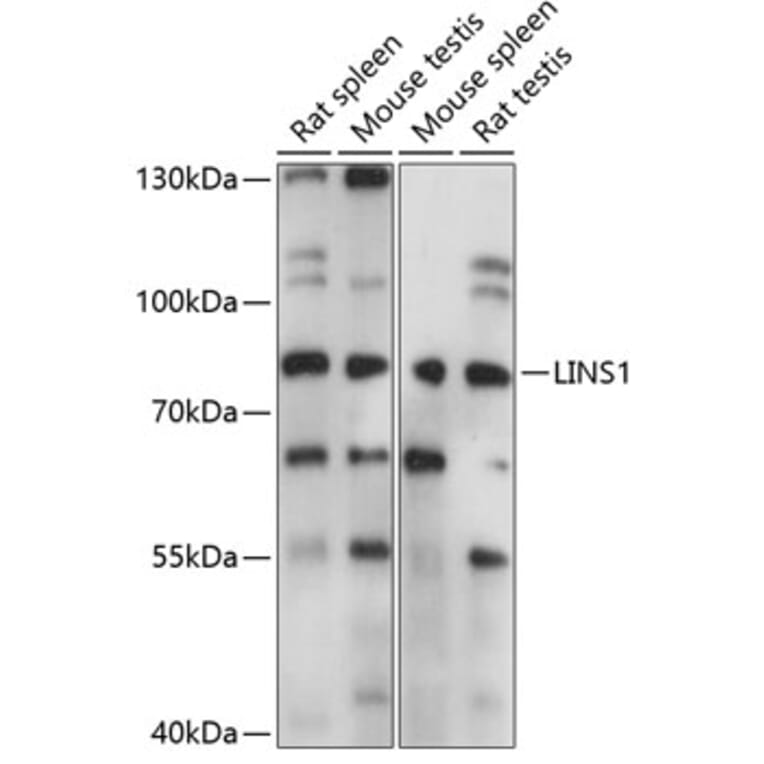 Western Blot - Anti-LINS1 Antibody (A91359) - Antibodies.com