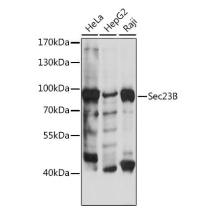 Western Blot - Anti-SEC23B Antibody (A91360) - Antibodies.com