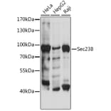 Western Blot - Anti-SEC23B Antibody (A91360) - Antibodies.com