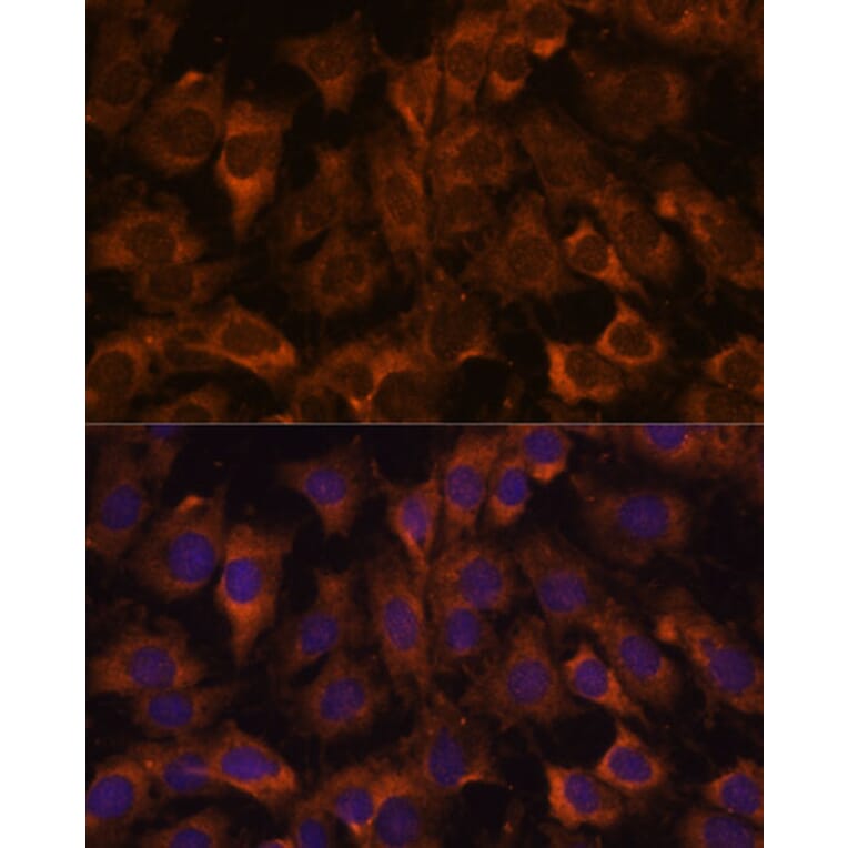 Immunofluorescence - Anti-SEC23B Antibody (A91360) - Antibodies.com