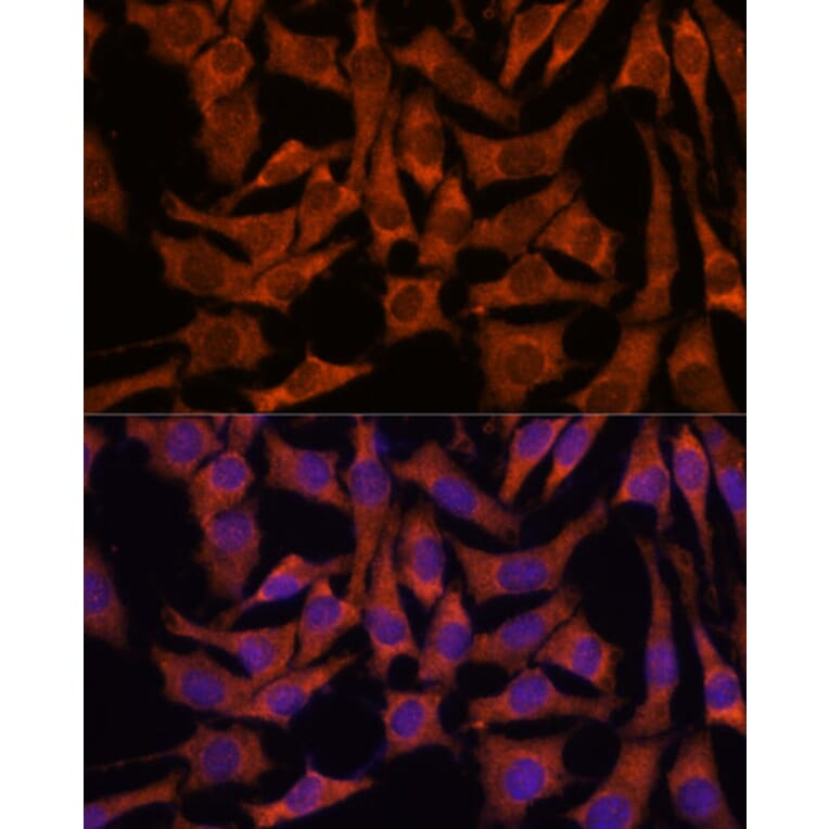 Immunofluorescence - Anti-SEC23B Antibody (A91360) - Antibodies.com