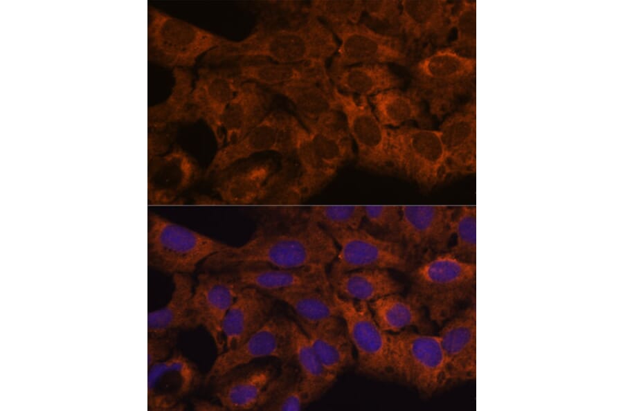 Immunofluorescence - Anti-SEC23B Antibody (A91360) - Antibodies.com