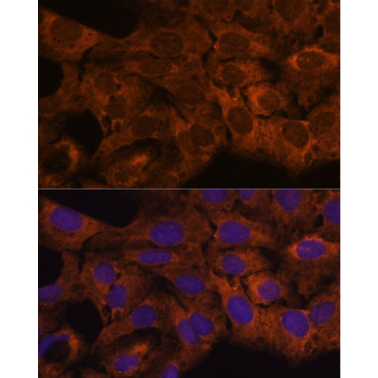 Immunofluorescence - Anti-SEC23B Antibody (A91360) - Antibodies.com