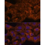 Immunofluorescence - Anti-SEC23B Antibody (A91360) - Antibodies.com