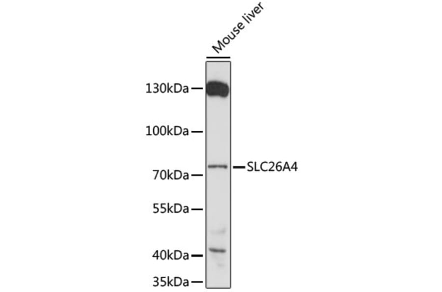 Western Blot - Anti-SLC26A4 Antibody (A91361) - Antibodies.com