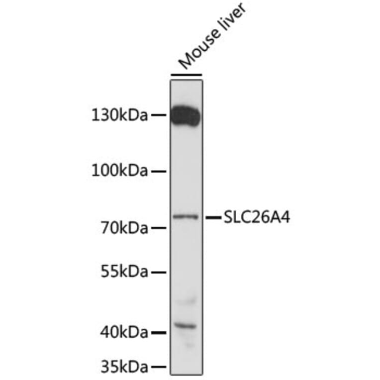 Western Blot - Anti-SLC26A4 Antibody (A91361) - Antibodies.com