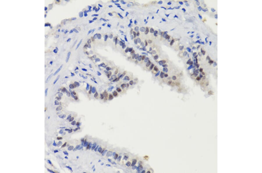 Immunohistochemistry - Anti-STAT3 (phospho Ser727) Antibody (A91363) - Antibodies.com
