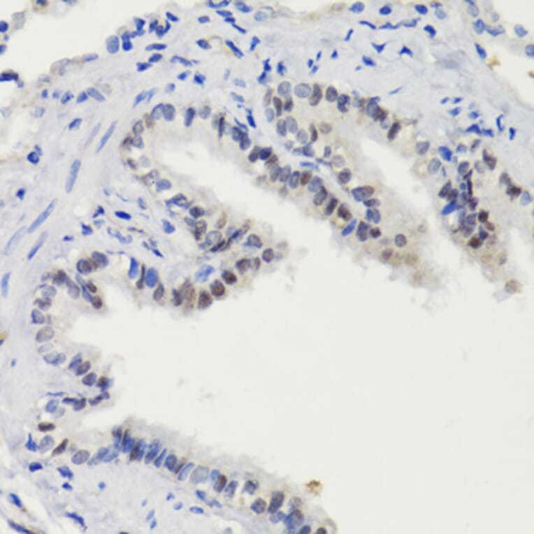 Immunohistochemistry - Anti-STAT3 (phospho Ser727) Antibody (A91363) - Antibodies.com