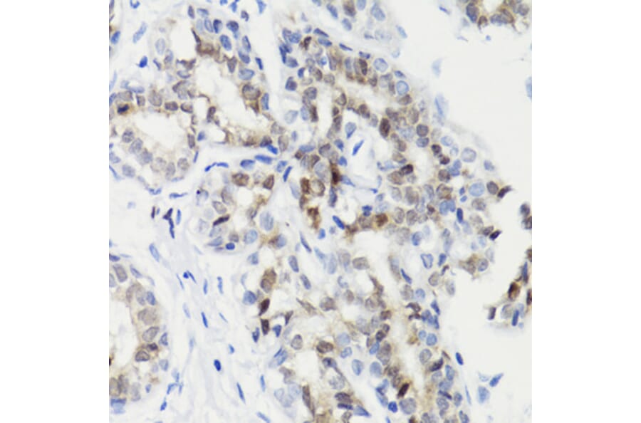 Immunohistochemistry - Anti-STAT3 (phospho Ser727) Antibody (A91363) - Antibodies.com