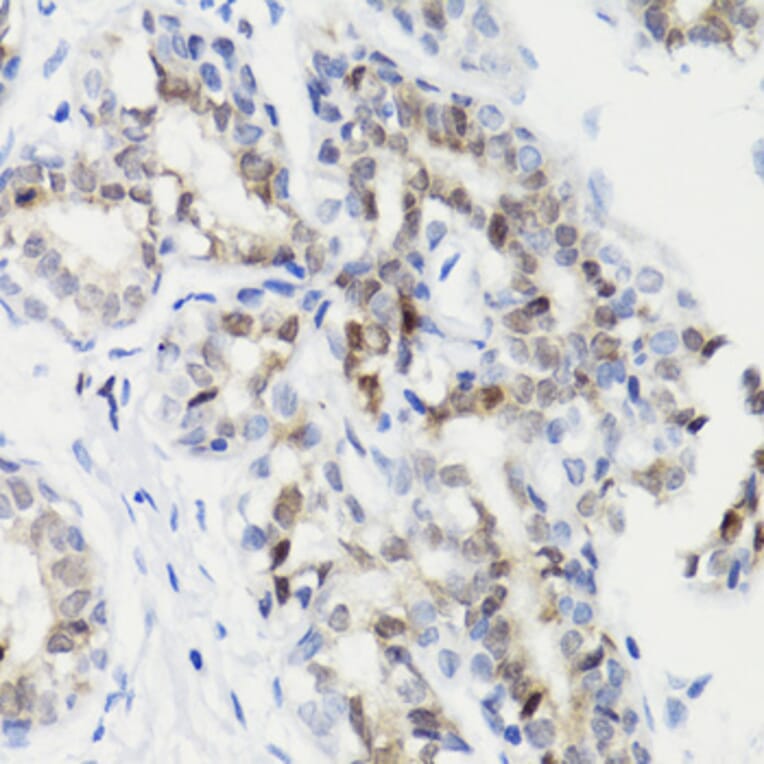 Immunohistochemistry - Anti-STAT3 (phospho Ser727) Antibody (A91363) - Antibodies.com