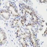Immunohistochemistry - Anti-STAT3 (phospho Ser727) Antibody (A91363) - Antibodies.com