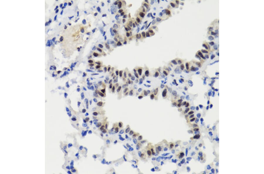 Immunohistochemistry - Anti-STAT3 (phospho Ser727) Antibody (A91363) - Antibodies.com