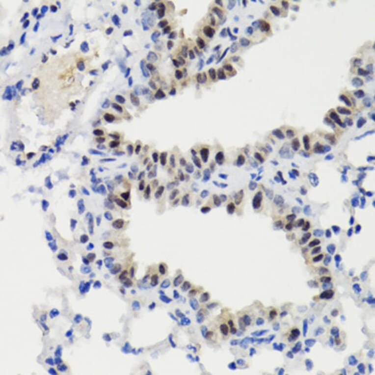 Immunohistochemistry - Anti-STAT3 (phospho Ser727) Antibody (A91363) - Antibodies.com