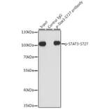 Western Blot - Anti-STAT3 (phospho Ser727) Antibody (A91363) - Antibodies.com