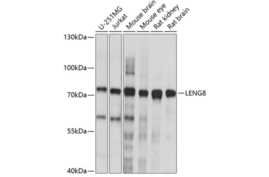Western Blot - Anti-LENG8 Antibody (A91364) - Antibodies.com