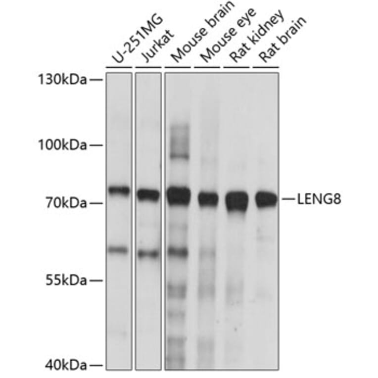 Western Blot - Anti-LENG8 Antibody (A91364) - Antibodies.com