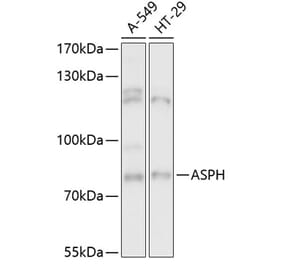 Western Blot - Anti-Aspartate beta hydroxylase Antibody (A91365) - Antibodies.com