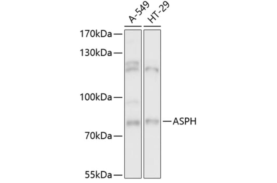 Western Blot - Anti-Aspartate beta hydroxylase Antibody (A91365) - Antibodies.com