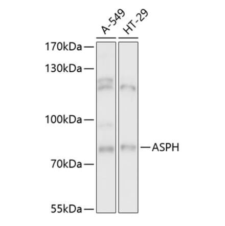 Western Blot - Anti-Aspartate beta hydroxylase Antibody (A91365) - Antibodies.com