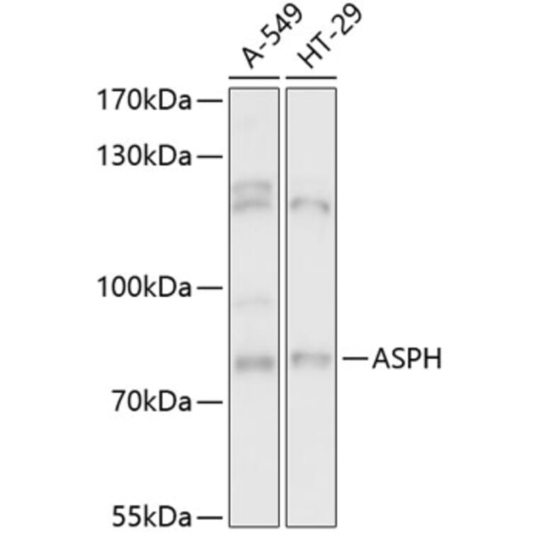 Western Blot - Anti-Aspartate beta hydroxylase Antibody (A91365) - Antibodies.com