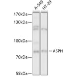 Western Blot - Anti-Aspartate beta hydroxylase Antibody (A91365) - Antibodies.com