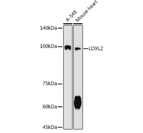 Western Blot - Anti-LOXL2 Antibody (A91366) - Antibodies.com