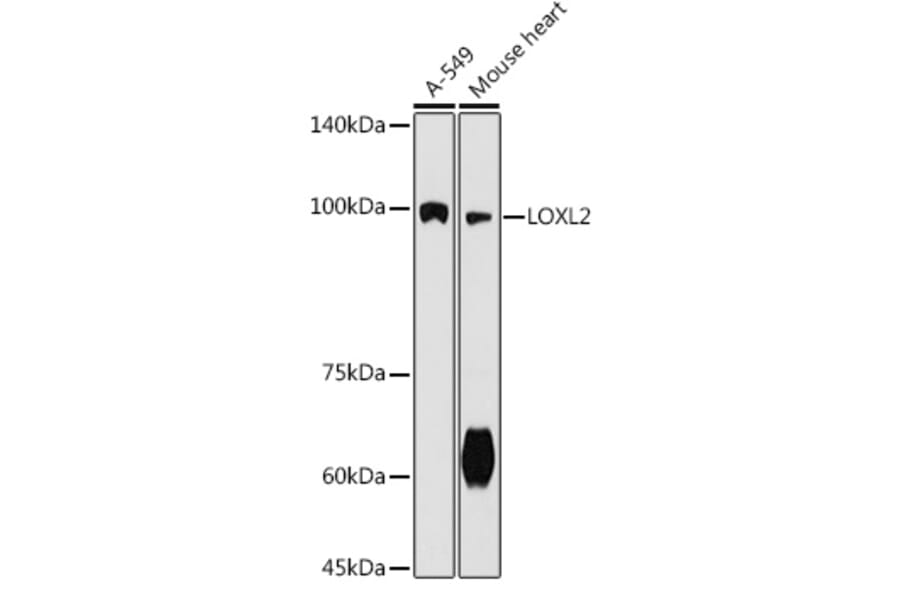 Western Blot - Anti-LOXL2 Antibody (A91366) - Antibodies.com