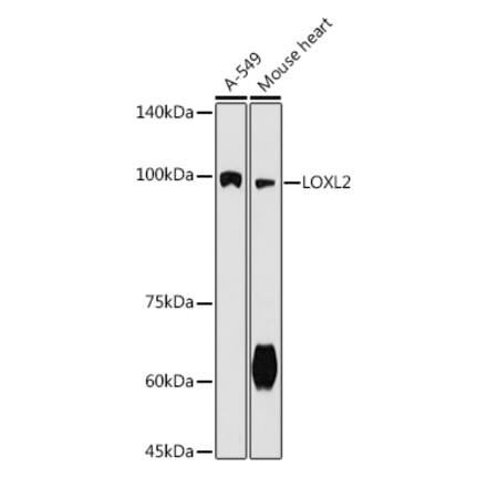 Western Blot - Anti-LOXL2 Antibody (A91366) - Antibodies.com