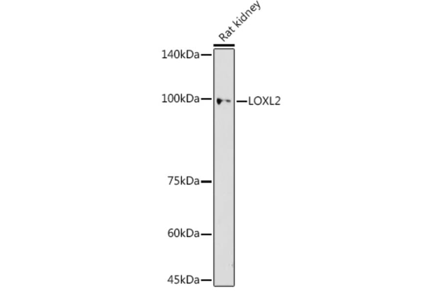 Western Blot - Anti-LOXL2 Antibody (A91366) - Antibodies.com