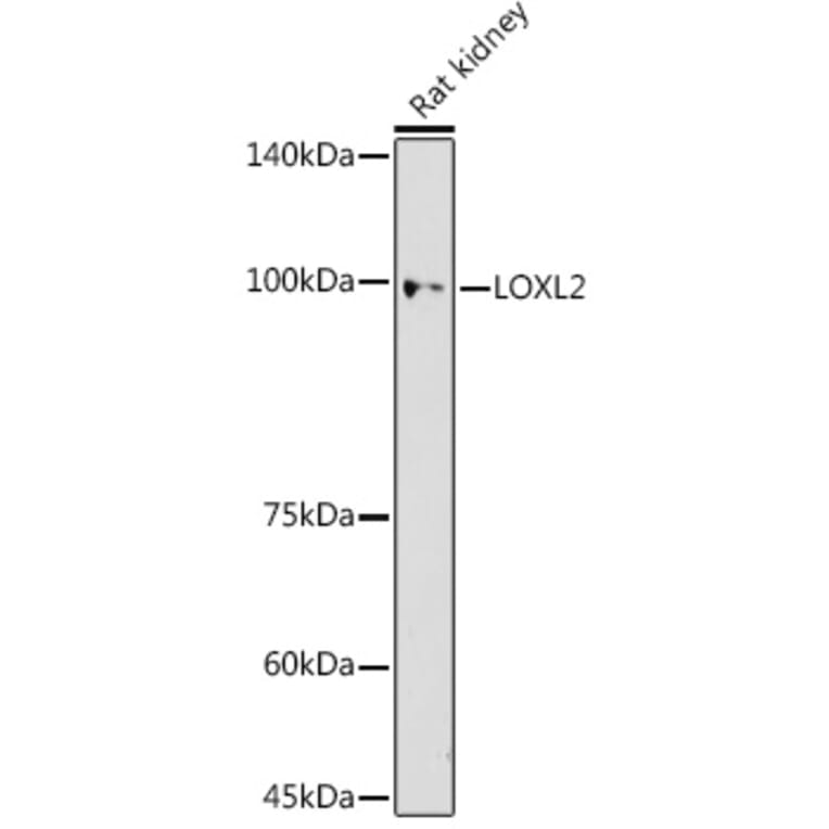 Western Blot - Anti-LOXL2 Antibody (A91366) - Antibodies.com