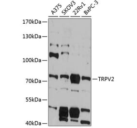 Western Blot - Anti-TRPV2 Antibody (A91369) - Antibodies.com