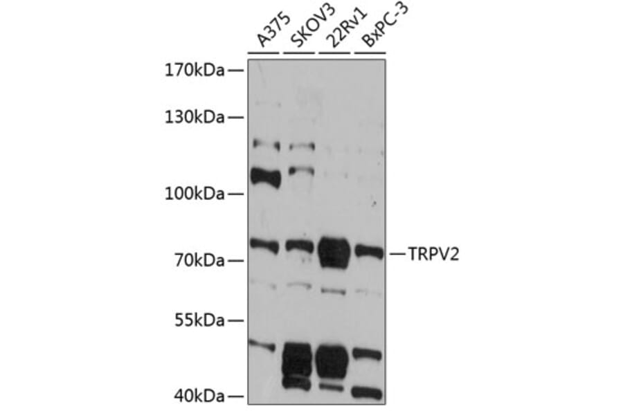 Western Blot - Anti-TRPV2 Antibody (A91369) - Antibodies.com
