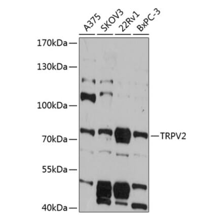 Western Blot - Anti-TRPV2 Antibody (A91369) - Antibodies.com