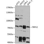 Western Blot - Anti-TRPV2 Antibody (A91369) - Antibodies.com
