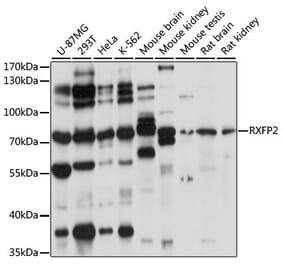 Western Blot - Anti-RXFP2 Antibody (A91371) - Antibodies.com