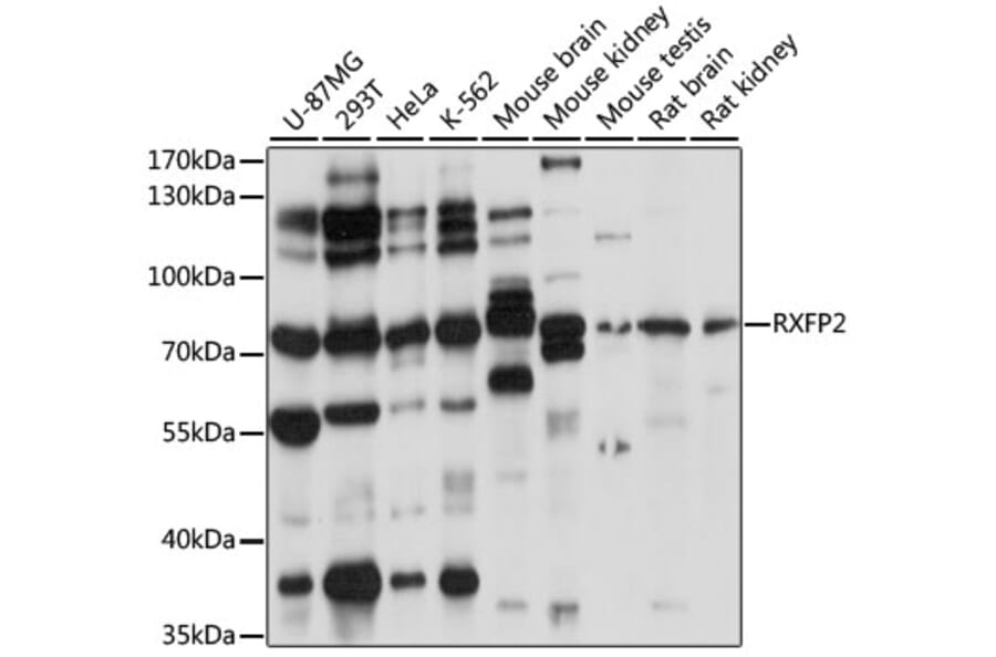 Western Blot - Anti-RXFP2 Antibody (A91371) - Antibodies.com