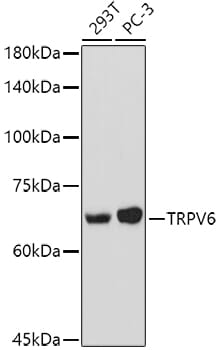 Western blot analysis of extracts of various cell lines, using Anti-TRPV6 Antibody (A16128) at 1:1,000 dilution.
Secondary antibody: Goat Anti-Rabbit IgG (H+L) (HRP) (AS014) at 1:10,000 dilution.
Lysates / proteins: 25µg per lane.
Blocking buffer: 3% non-fat dry milk in TBST.
Detection: ECL Basic Kit (RM00020).
Exposure time: 30s.