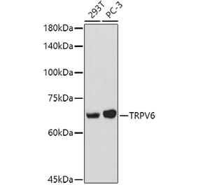 Western Blot - Anti-TRPV6 Antibody (A91372) - Antibodies.com
