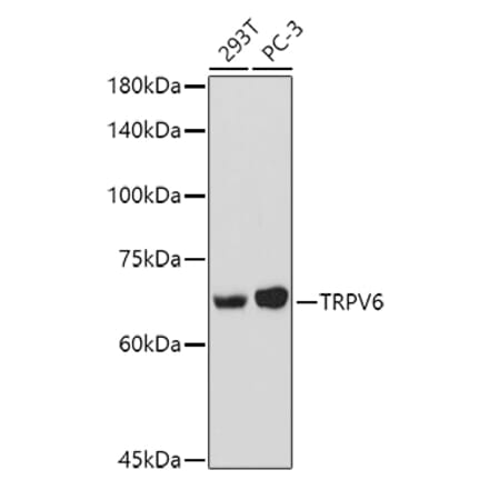 Western Blot - Anti-TRPV6 Antibody (A91372) - Antibodies.com