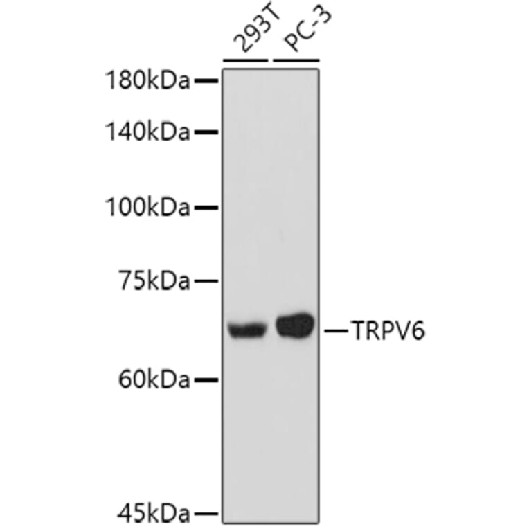 Western Blot - Anti-TRPV6 Antibody (A91372) - Antibodies.com