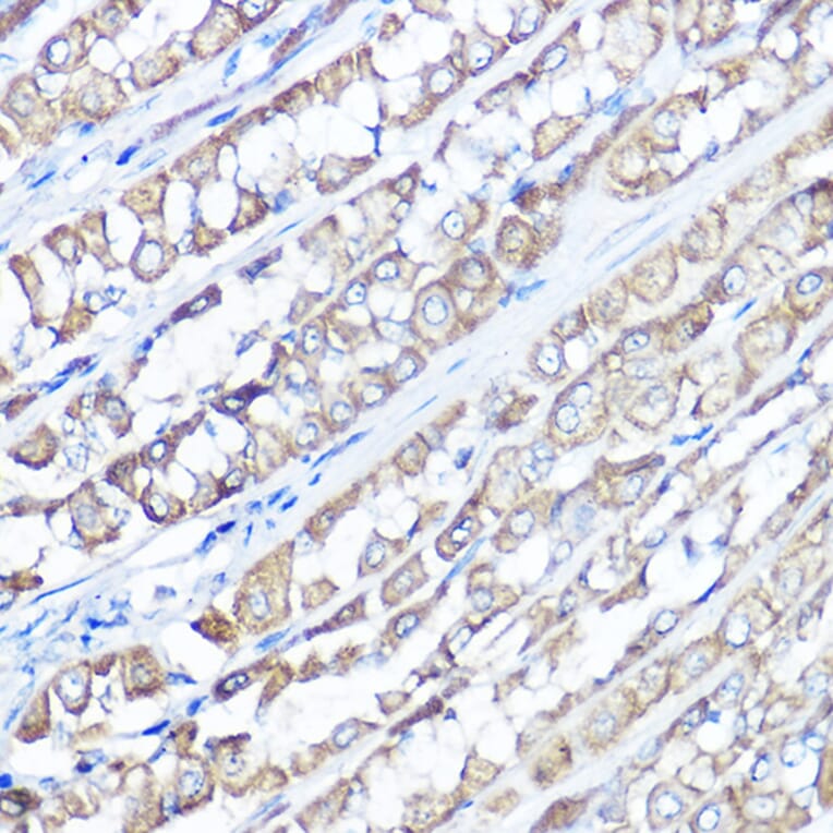 Immunohistochemistry - Anti-TRPV6 Antibody (A91372) - Antibodies.com