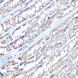 Immunohistochemistry - Anti-TRPV6 Antibody (A91372) - Antibodies.com