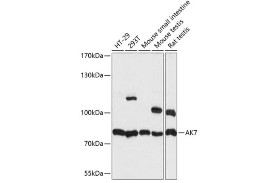 Western Blot - Anti-AK7 Antibody (A91374) - Antibodies.com