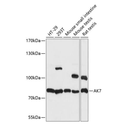 Western Blot - Anti-AK7 Antibody (A91374) - Antibodies.com